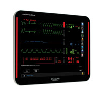 Patient Monitoring